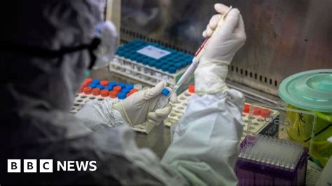 Coronavirus First Case Confirmed In Republic Of Ireland