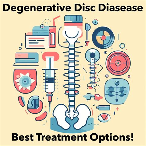 Best Degenerative Disc Disease Treatment Options Explained 1 List