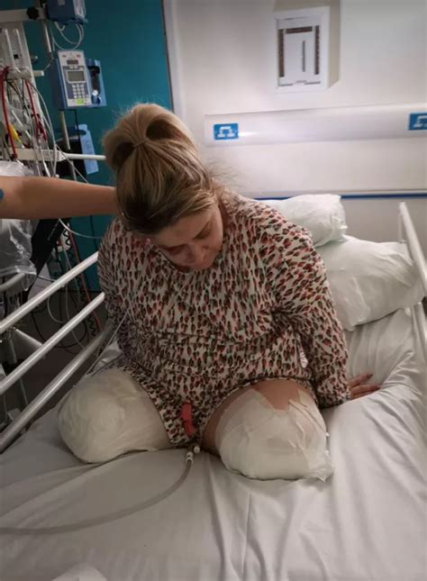 Scots Woman Who Lost Both Legs After Suicide Attempt Left Her With Horror Complications Begs