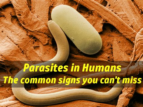 Parasite Symptoms Common Signs Of Parasites In Humans You Cant Miss