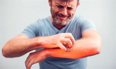 Ask The Gp What Can I Do About My Unbearable Itch Dr Martin Scurr