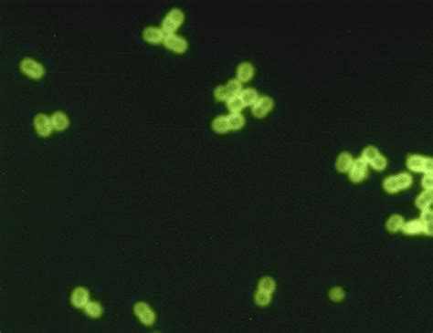 Streptococcus Pneumoniae And Staphylococci