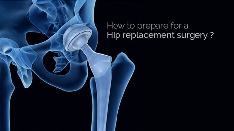 How To Prepare For Hip Replacement Surgery Health Travellers