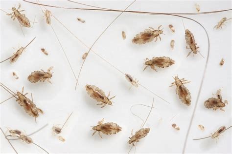 Lice Control And Treatments For The Home Clothing And Hair