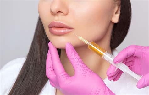 Dermal Filler Lip Injections National Laser Institute Medical Spa