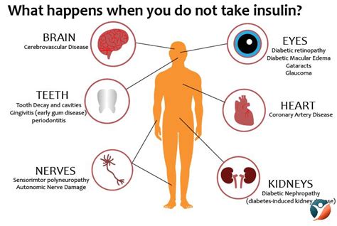 What Happens If A Diabetic Does Not Take Insulin Diabeteswalls