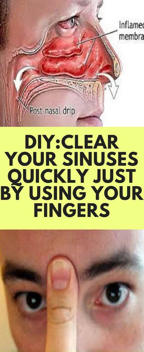 Diyclear Your Sinuses Quickly Just By Using Your Fingers Sinusitis