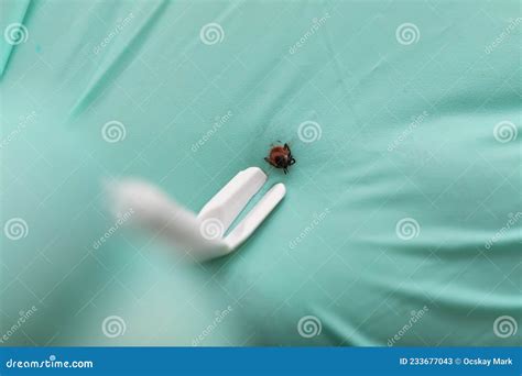 Removing Tick From Human Skin Stock Image Image Of Hair Louse 233677043