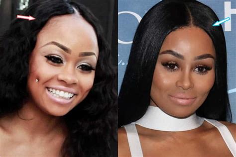 did black chyna have plastic surgery before and after 2021