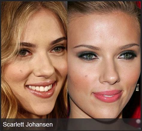 Celebrities Before And After Plastic Surgeries Celebrities