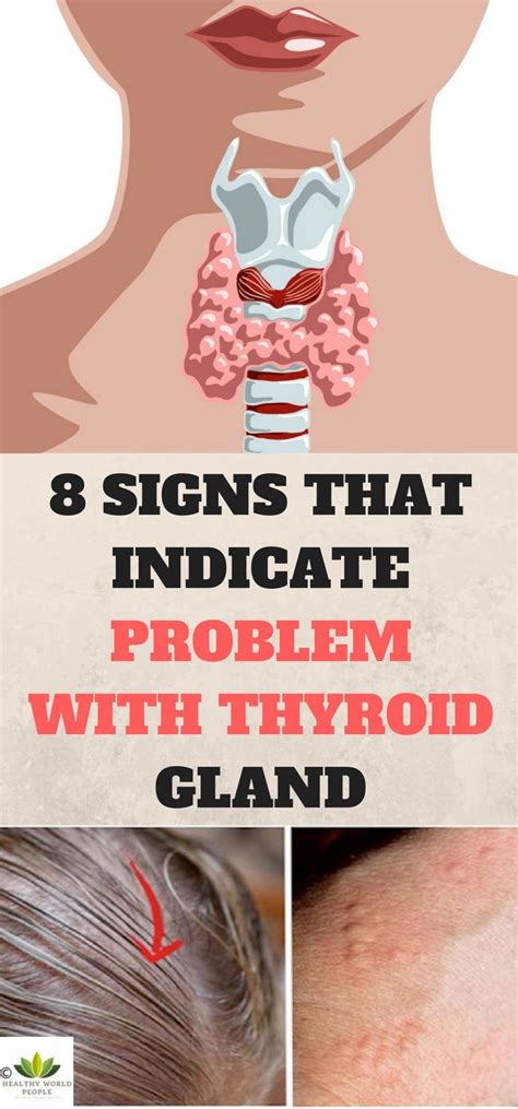 The Thyroid Gland Is Located On The Front Side Of Your Neck And It Has