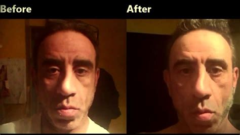 Before And After Photos 50 Year Old Man Face Exercises