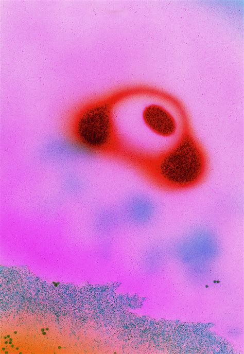 Mycoplasma Pneumoniae Bacteria Photograph By Dr Kari Lounatmaascience
