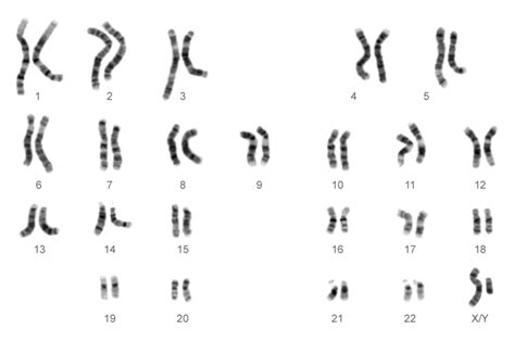 nnhsbiology chromosomes and karyotypes 10336 hot sex picture