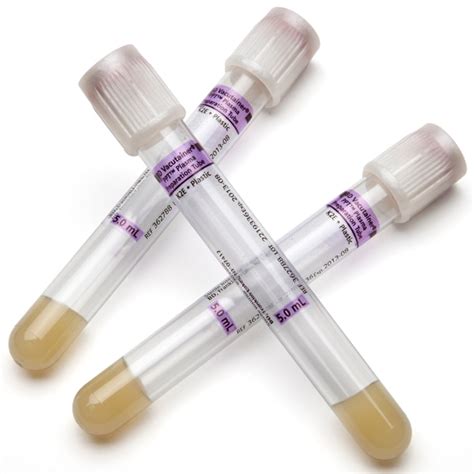 Bd Vacutainer Ppt Plasma Preparation Tube Ppt Edta Tube Mm X Mm Hot