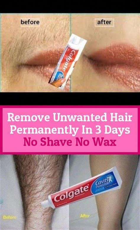 Pin On Female Facial Hair Removal