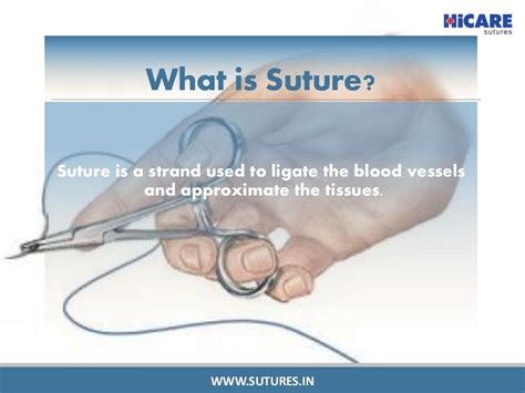 What Are Sutures And Types Of Suture By Hicare Sutures Via Slideshare
