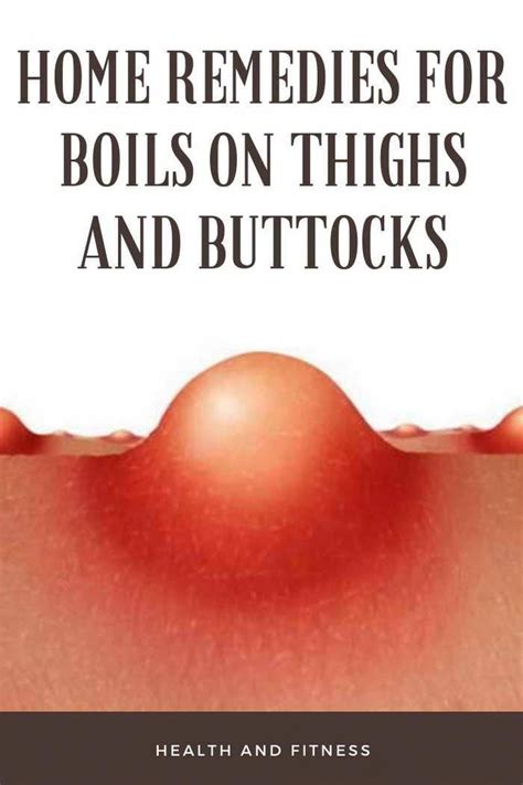 Home Remedies For Boils On Thighs And Buttocks Teenagersskincare Home Remedy For Boils Home