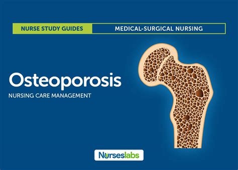 Osteoporosis Nursing Care Management And Study Guide Nurseslabs