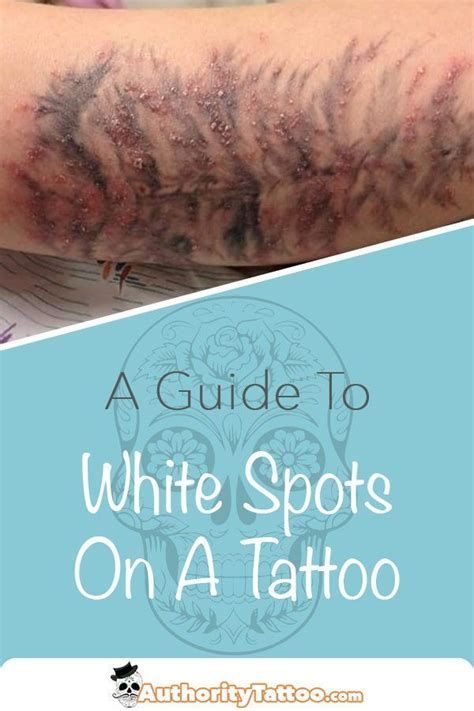 White Bumps And Spots On New And Old Tattoos What Are They Met