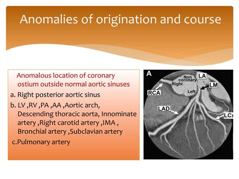 This observational study proposes a new anatomical working classification for cs for purposes of successful lv lead placement and optimal operative success. PPT - Coronary Artery Anomalies PowerPoint Presentation ...