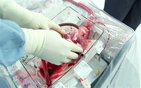 Heart In A Box Device Can Revive Hearts For Transplant Nursing Crib