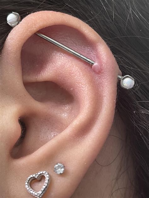 Fighting These Piercing Bumps On My Industrial For 2 Years Help Rpiercingadvice