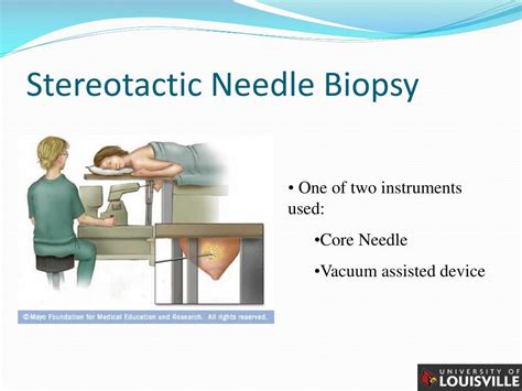 Stereotactic Core Needle Biopsy Procedure Hot Sex Picture