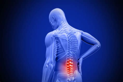 Lower Back Pain Symptoms Causes Treatment And Prevention