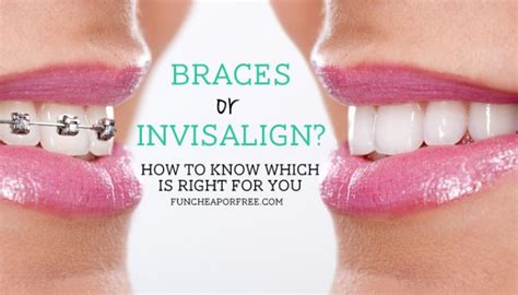 Invisalign Cost Vs Braces Cost How To Budget Fun Cheap Or Free Invisalign Braces Cost