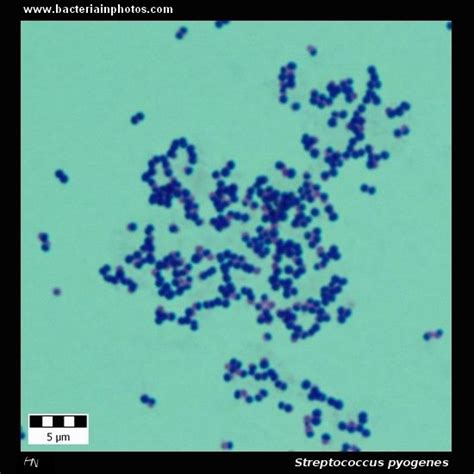 Streptococcus Pyogenes Microscopy Gram Positive Cocci Bacteria