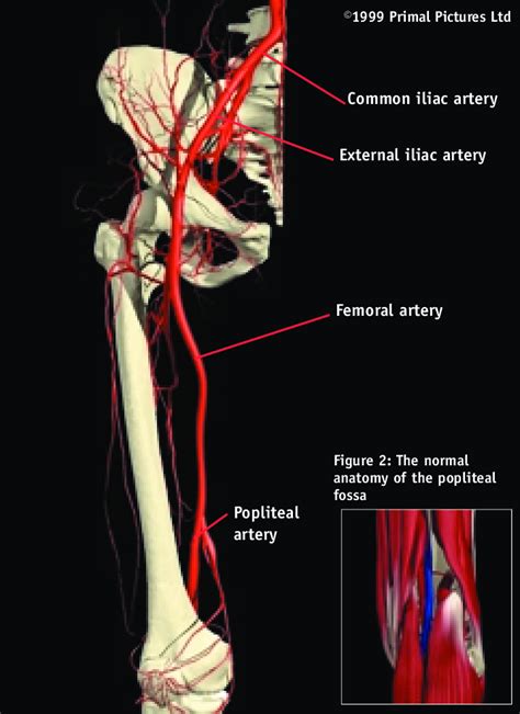 Image Result For Flow Chart Of Arteries Lower Limb Le