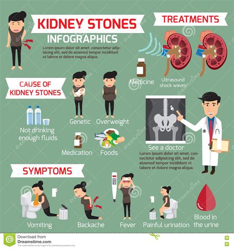 Kidney Stone Infographic Detail Medical Set Elements Stock Vector