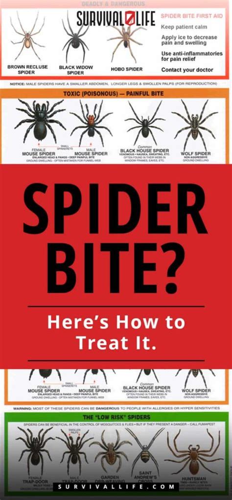 Spider Bite Heres How To Treat It How To Handle A Spider Bite