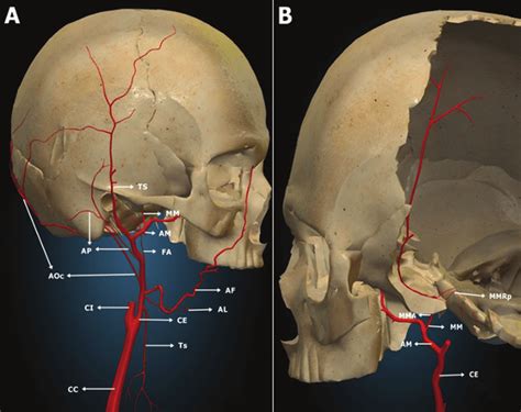 Representation Of The External Carotid Artery And Its Branches A