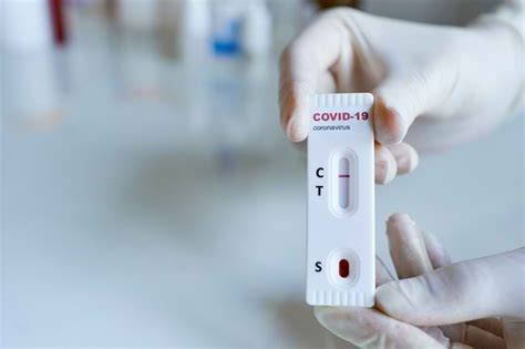 Coronalab uses rapid antigen testing from sd biosensor and roche. Hasil Rapid Test COVID-19 Negatif, Apa Artinya? - Alodokter