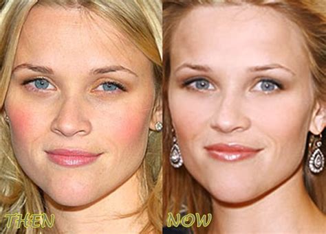 Reese Witherspoon Plastic Surgery Before After Breast Implants