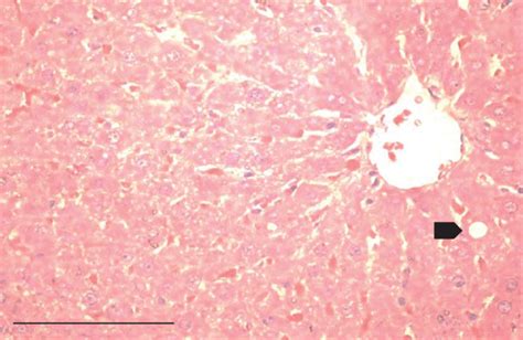 Photomicrographs Of The Liver Stained With Hematoxylin And Eosin He Download Scientific