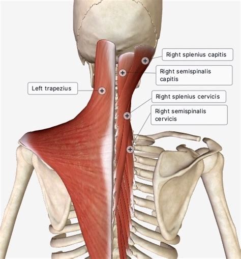 Muscles Of The Posterior Neck Trapezius Removed