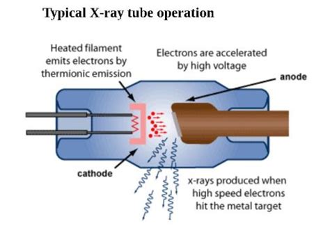 X Rays And Ionizing Radiation