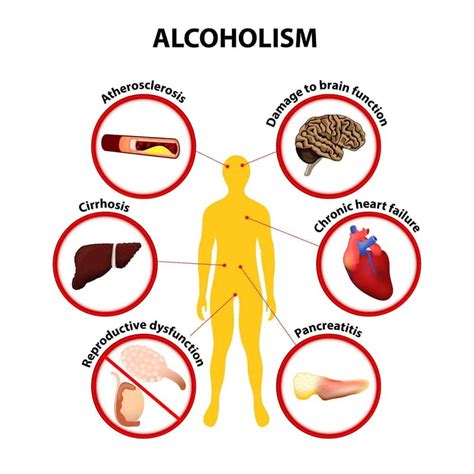 Top 7 Life Consequences Of Alcohol Abuse What You Should Know