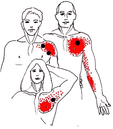 Related online courses on physioplus. ROUND EARTH PUBLISHING: INTRODUCTION TO SHOULDER PAIN