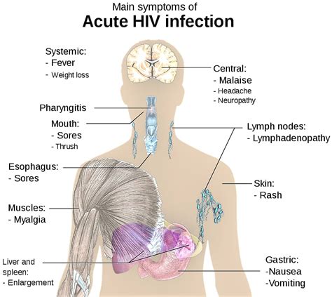 Hiv Human Immunodeficiency Virus Virology Notes