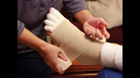 Compression Bandaging Of Lower Leg Lymphedema Youtube