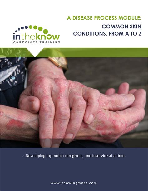 Common Skin Conditions From A To Z In The Know Caregiver Training