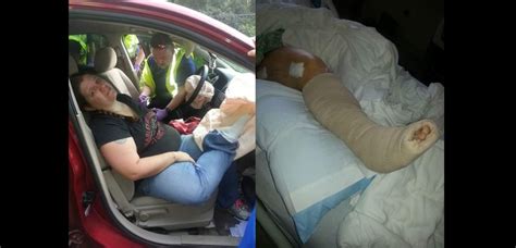 Moms Horrific Accident Shows Why You Should Never Put Your Feet On The