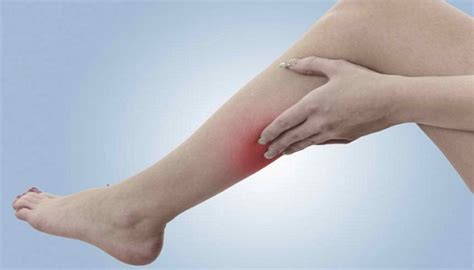 10 Signs And Symptoms Of Blood Clot In Leg