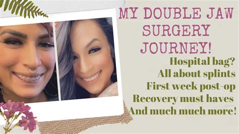 My Double Jaw Surgery Journey Experience 😃 10 Months Post Op Youtube