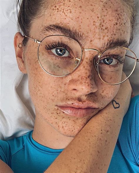Pin By Mocchaa On Freckles ️ Girls With Glasses Glasses Pretty Face
