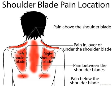 Shoulder Blade Pain Left Right Or Under Scapula Ehealthstar